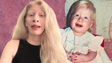 Vivir con albinismo: Ruby Vizcarra cuenta cómo superó los obstáculos y malos tratos