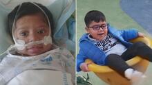 Este niño hispano nació con rara enfermedad y gracias a los televidentes de Primer Impacto logró sobrevivir