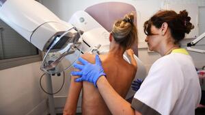 Por qué a partir de ahora la FDA exige que te informen sobre la densidad de tus mamas al hacerte la mamografía 